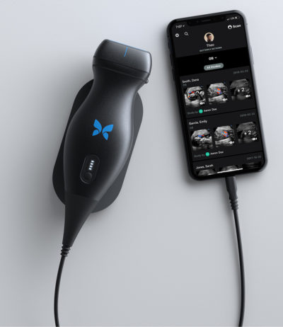 Butterfly iQ ultralydsscanner